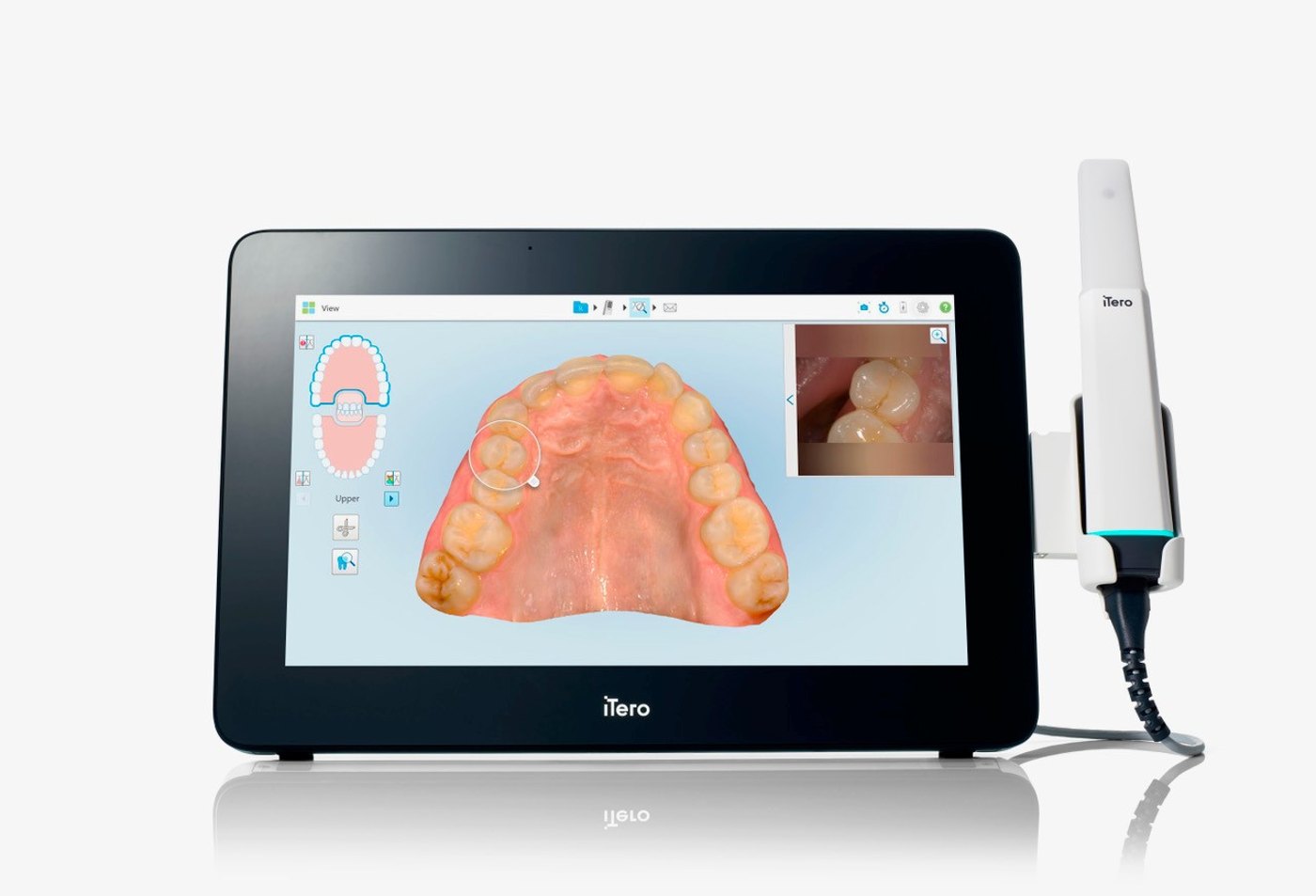 iTero digital 3D intraoral scanner used at Pinnacle Dental